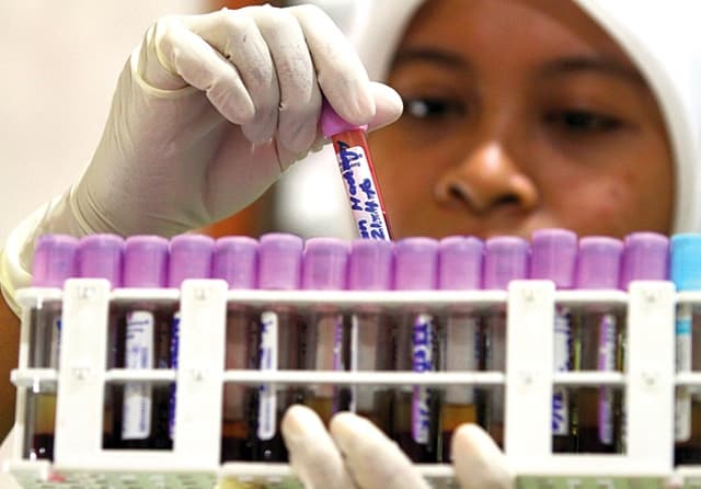 SKRINING: Diagnosis talasemia dapat diketahui lewat tes darah lengkap dan elektroforesis Hb. (Dite Surendra/Jawa Pos) - Image