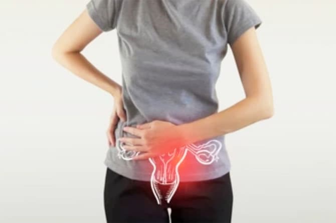 Ilustrasi kanker ovarium (ANTARA/Shutterstock/mi_viri) - Image